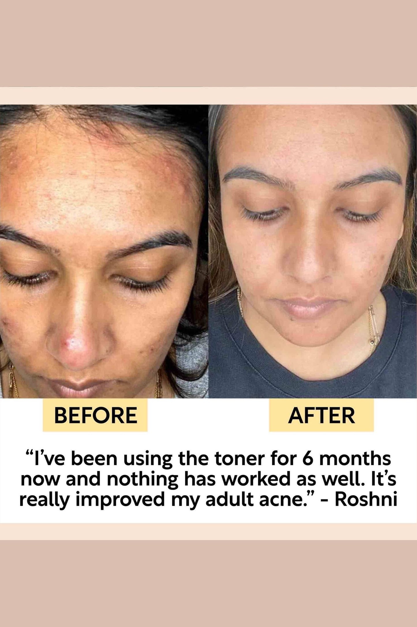 Face Toner with Hyaluronic Acid