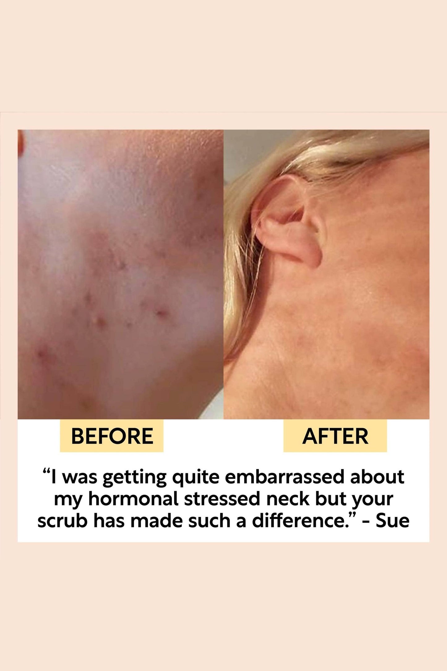 Vegan Face Scrub with Coffee + Rosehip [Citrus blend] Exfoliator