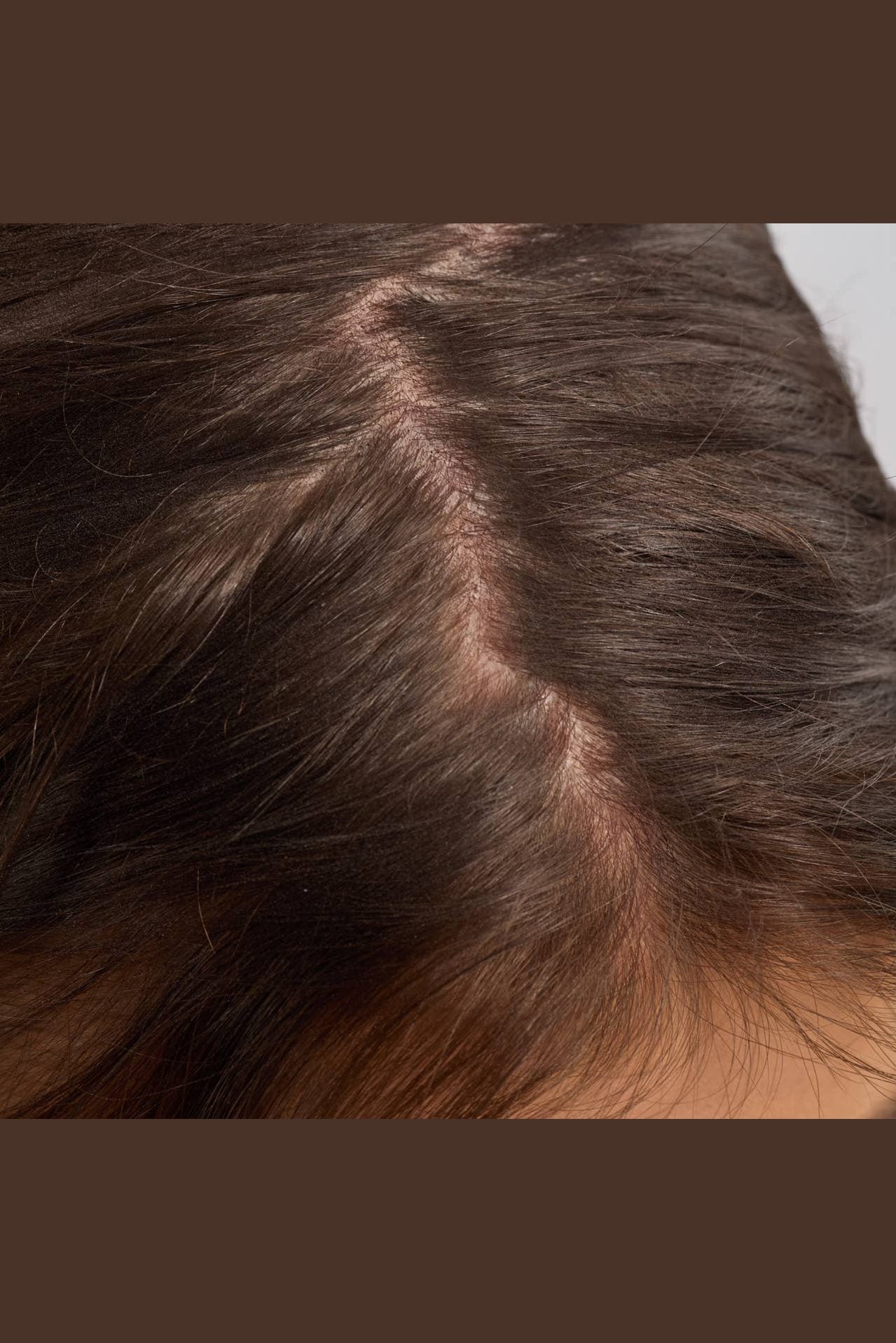 Strengthening Hair & Scalp Oil